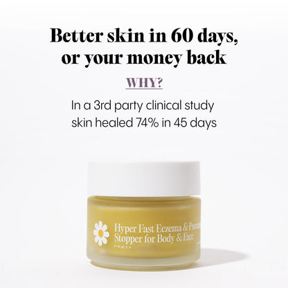 Ultra-Fast Relief Balm for Dry, Itchy Skin – For Body & Face