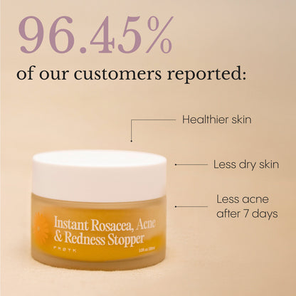 Instant Rosacea, Acne & Redness Stopper