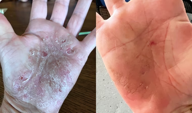 Before and After