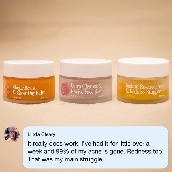 The Complete Acne System for Women